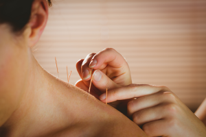 acupunctuur weerstand